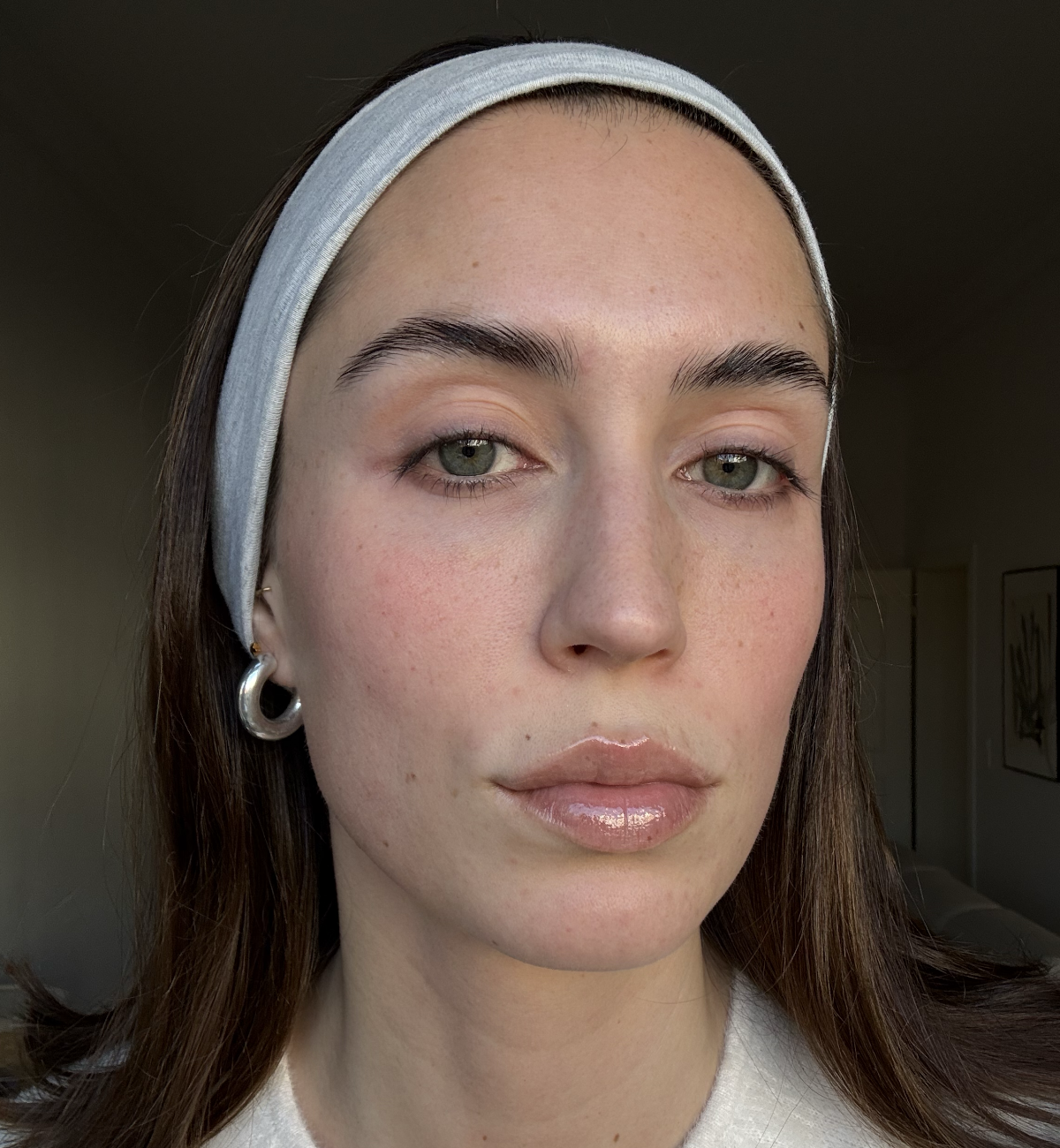 augenpads sensible haut, Haut vor der Anwendung, Sensitive Eye Patches