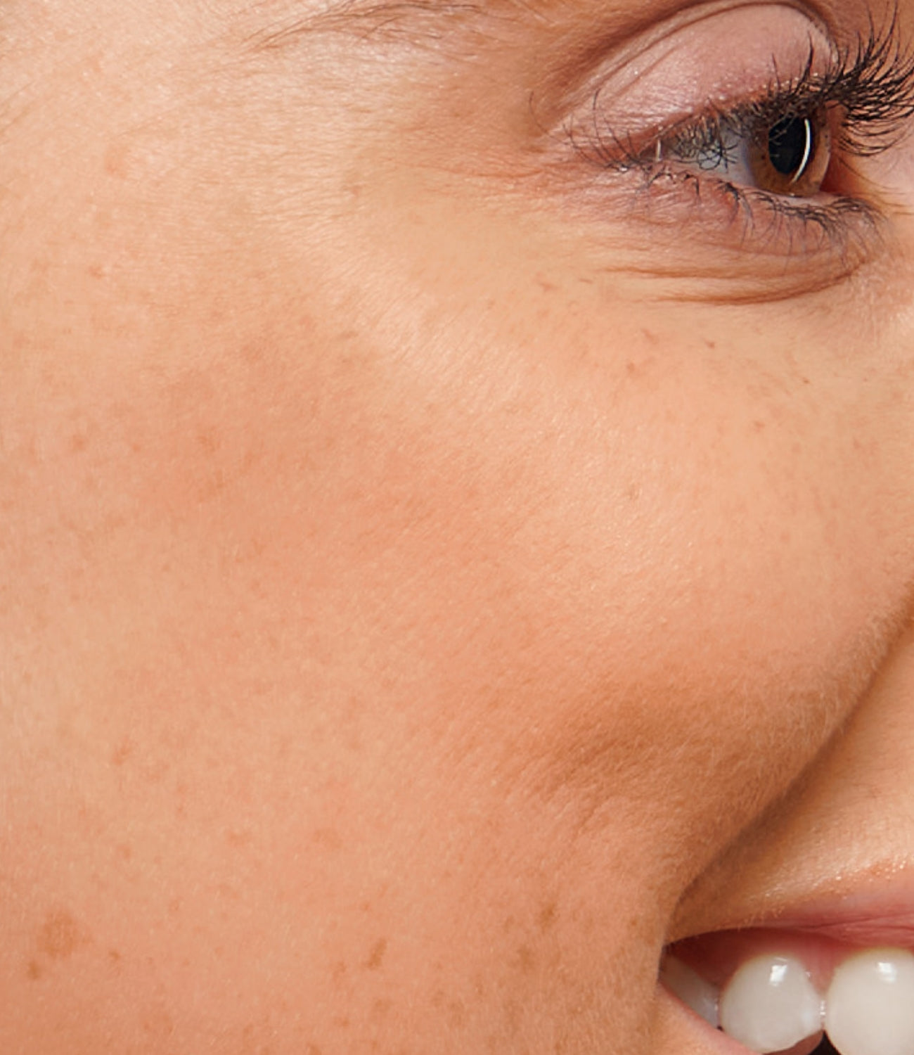 Sensible Haut, Hautbild, HEJ ORGANIC