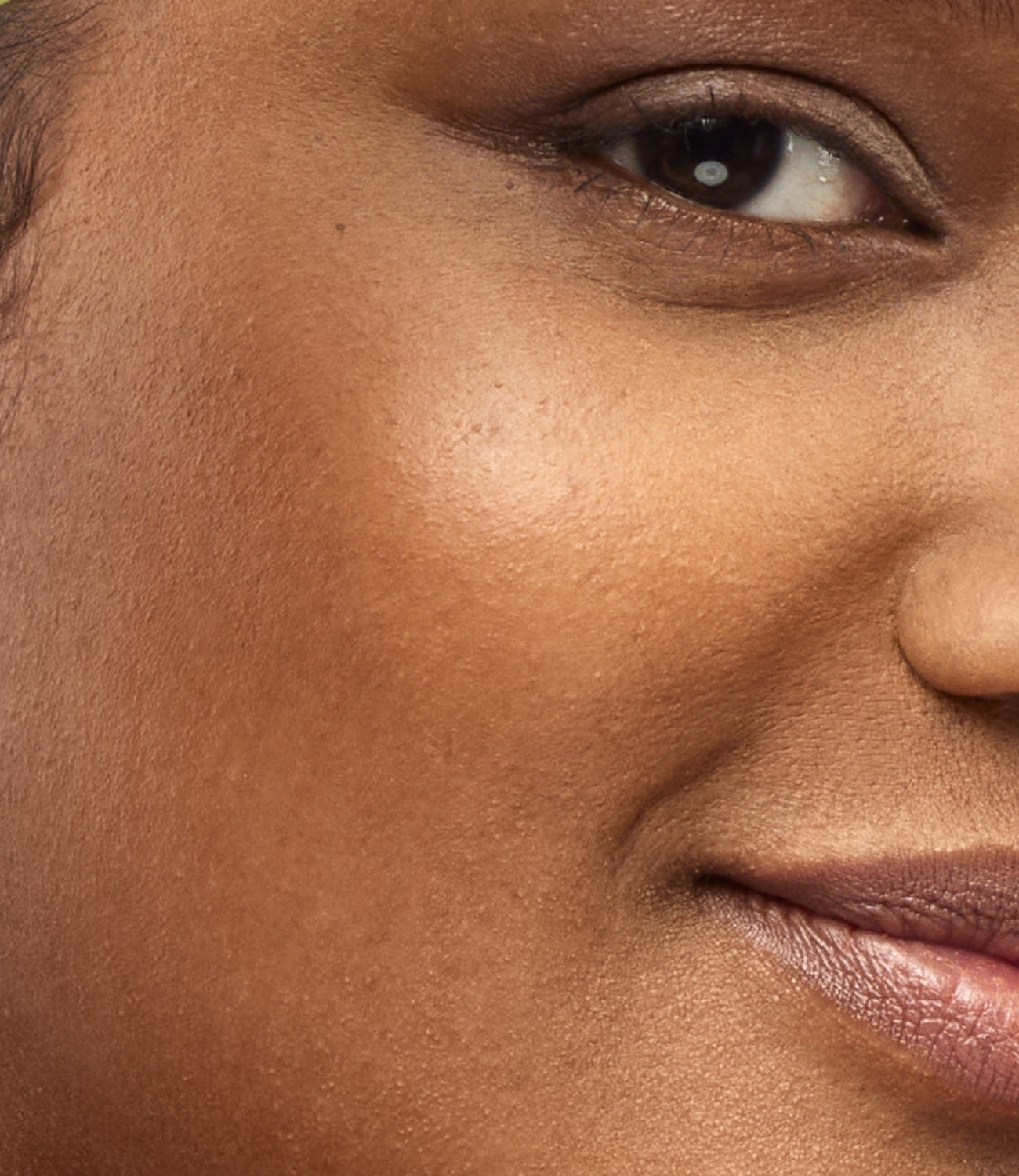 Trockene Haut, Hautbild, HEJ ORGANIC