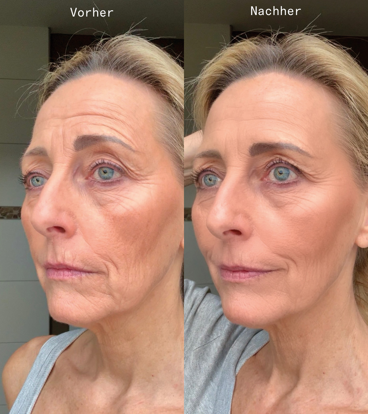 Skin Longevity, Produkttest vorher/nachher, HEJ ORGANIC