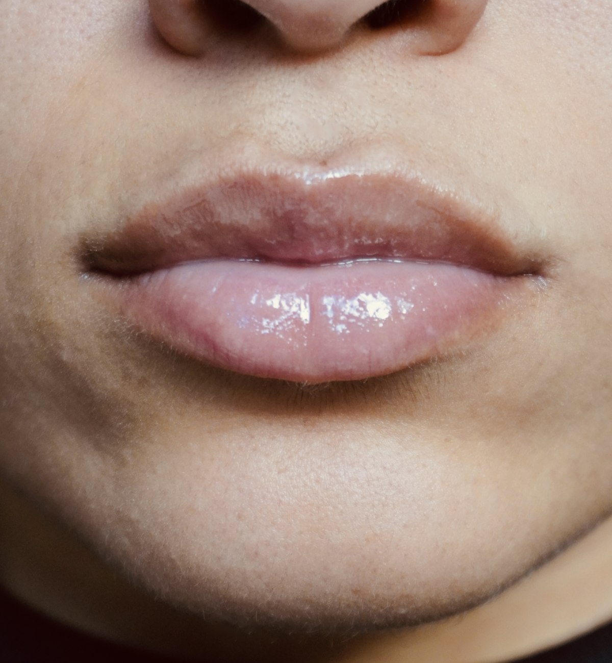 peptide lip treatment, Lippen nach der Anwendung, Peptide Lip Treatment