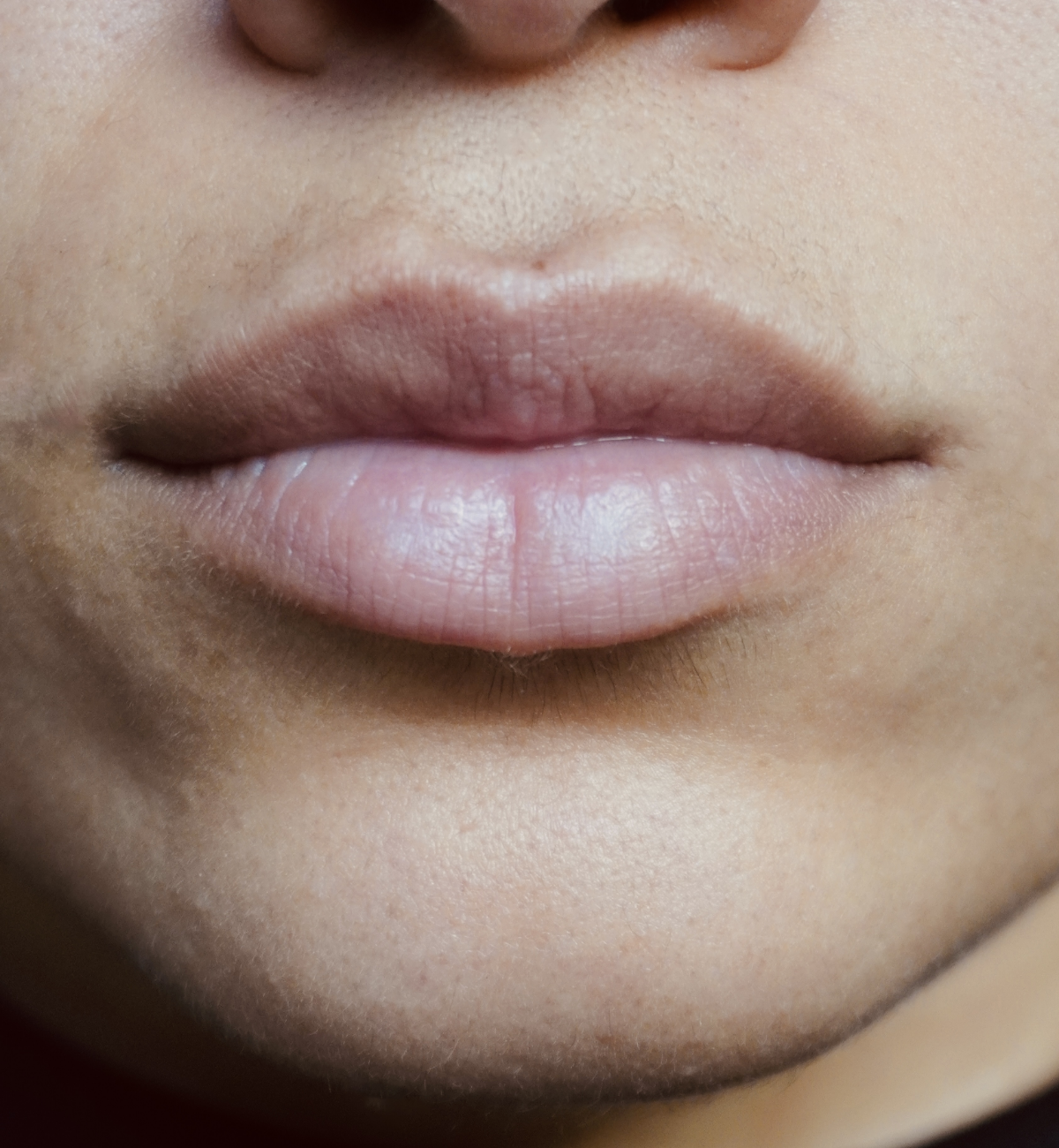 peptide lip treatment, Lippen vor der Anwendung, Peptide Lip Treatment